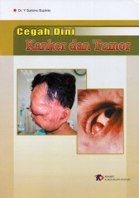 Cegah dini kanker dan tumor